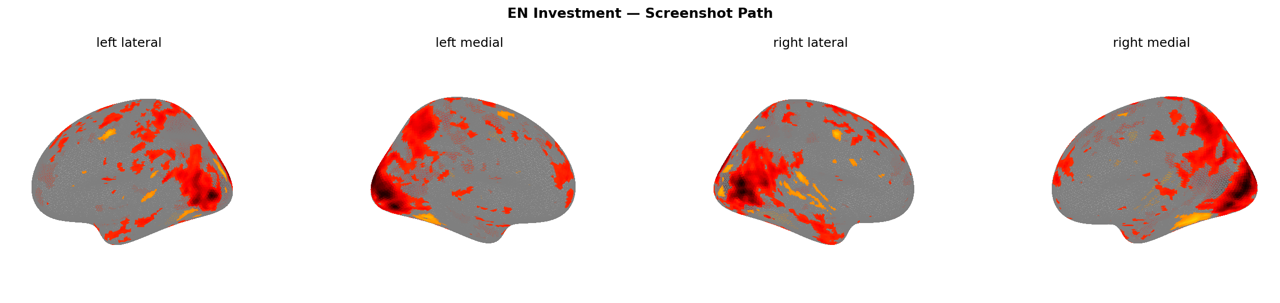Investment screenshot brain map