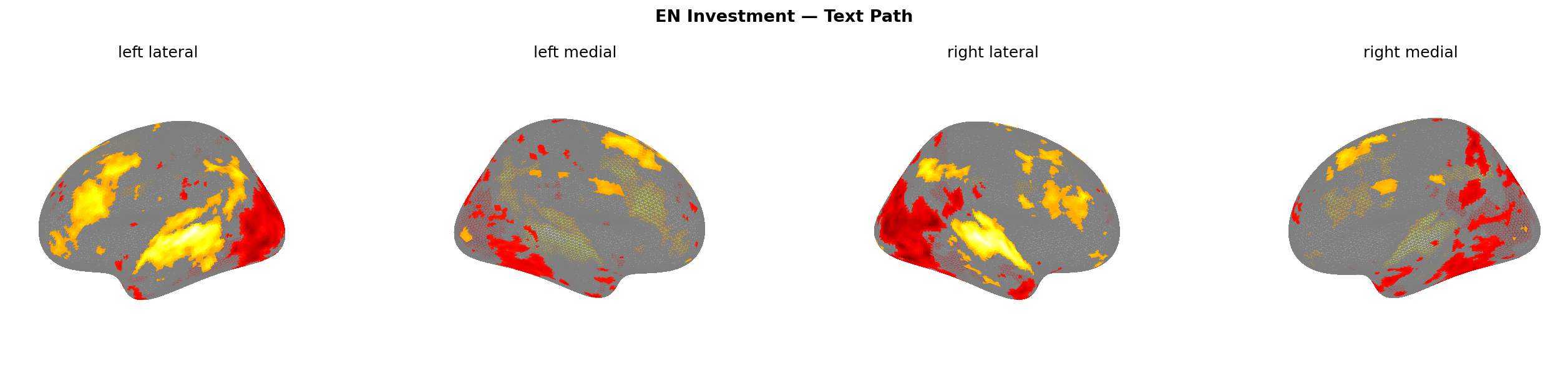 Investment text brain map